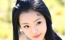 治疗胎记防上当 色素治疗得不偿失