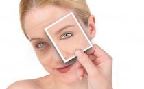 如何去除肿眼泡及后遗症