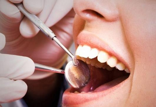 牙齿矫正术后的护理方法