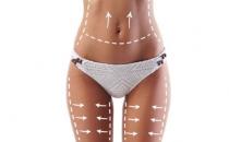 吸脂减肥有哪些风险？