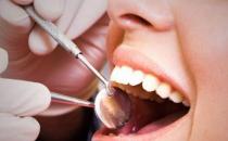 牙齿矫正术后的护理方法