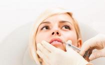 了解唇部有哪些整形手术