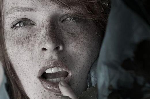 面部斑点是如何滋生的？又该如何预防？