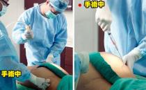 女性吸脂瘦腰有哪些疑问