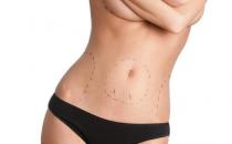 7招击退腰部赘肉的方法