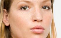 最有效祛斑小妙招 还你娇嫩瓷肌