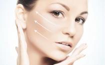 激光去胎记有哪些好处