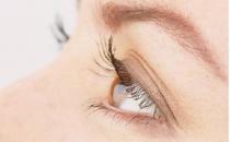 电脑一族的眼睛食疗保健法