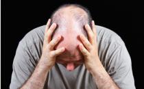 脱发男必看！防脱只需五招