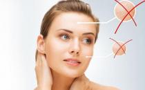 你在等痘痘熟透吗？手痒挤痘误大事