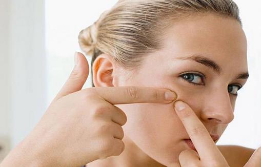 痘痘愈后不能放松 痘疤是最大敌人