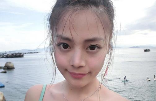 痘痘告诉你哪生病了