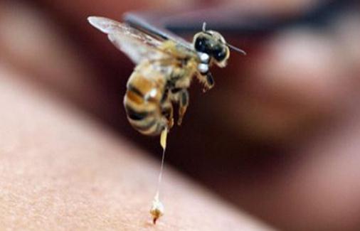 被蜂蜇了怎么办？被蜂蜇的急救方法