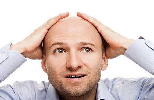 秃顶的原因 七个习惯防止男人秃顶