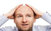 秃顶的原因 七个习惯防止男人秃顶