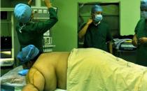 抽脂的5个秘密不可不知道