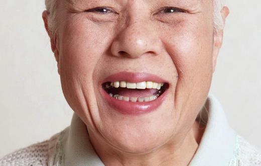 老年人怎样戴好假牙