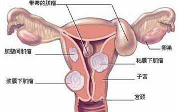 【子宫】子宫保健_子宫肌瘤,子宫内膜炎等子宫疾病预防和治疗知识