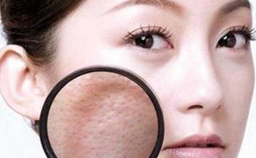 【毛孔粗大】皮肤毛孔粗大怎么办_毛孔粗大的原因_毛孔粗大解决方法