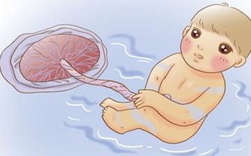 【脐带】脐带绕颈_脐带绕颈能顺产吗_正常脐带绕颈的调整方法_脐带两周不脱落怎么办