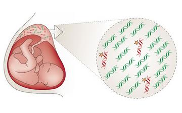 【遗传病】遗传病有哪些_家族遗传病都有哪些_遗传病的特点 【遗传病】遗传病有哪些_家族遗传病都有哪些_遗传病的特点