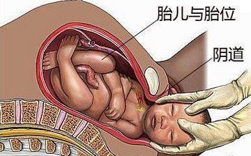 【分娩】分娩注意什么_分娩前的征兆_分娩视频全过程_分娩后吃什么补身体