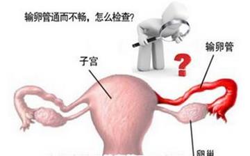 【输卵管堵塞】输卵管堵塞的症状_输软管堵塞检查项目有哪些_输软管不通怎么治疗 【输卵管堵塞】输卵管堵塞的症状_输软管堵塞检查项目有哪些_输软管不通怎么治疗