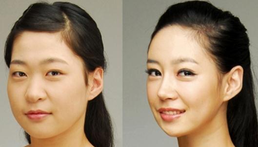 咬肌瘦脸针有什么危害？