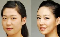 咬肌瘦脸针有什么危害？