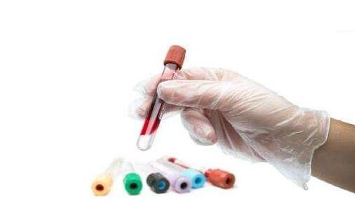 什么是血常规检查？血常规化验单怎么看？