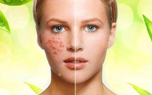 皮肤过敏干燥脱皮怎么办呢？