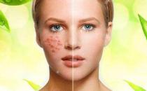 皮肤过敏干燥脱皮怎么办呢？