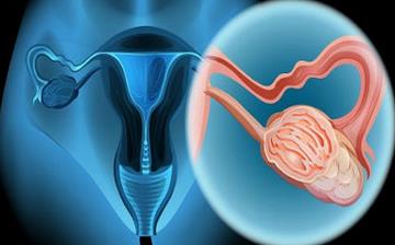 【宫颈癌】宫颈癌有哪些症状_宫颈癌如何治疗_宫颈癌的原因