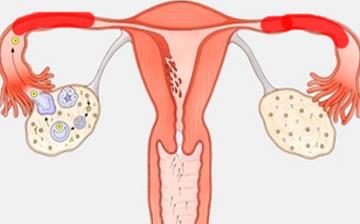 【女性生殖器结核】女性生殖器结核有哪些症状_女性生殖器结核如何治疗_女性生殖器结核的原因