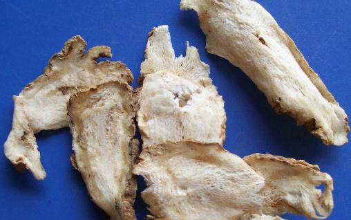 月经不调怎么办 6个方法让月经恢复正常