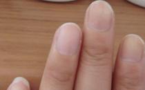 男人肾虚有哪些表现 看手指辨疾病