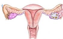 ​卵巢大小正常范围 什么是健康卵巢