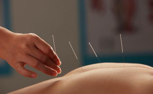 针灸能不能治疗失眠呢