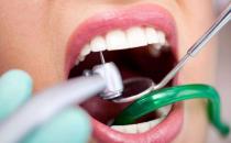 牙齿敏感是怎么回事