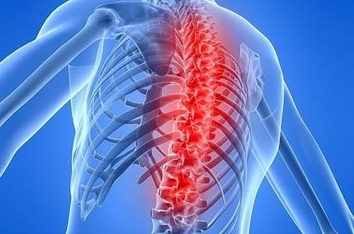 怎么做才有效预防腰椎病