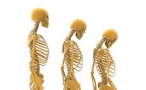 ​哪些方法可以预防骨质疏松