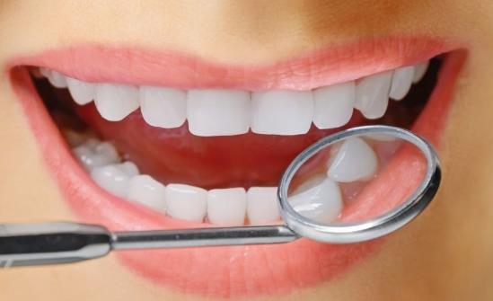 揭秘对洗牙的误区有哪些
