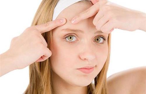 长痘痘的原因都有哪些