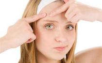 长痘痘的原因都有哪些