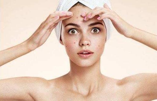 去除色斑需要注意这些误区