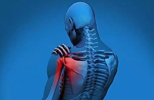 有效预防肩周炎的措施有哪些