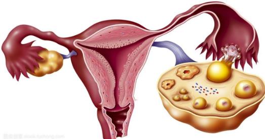 输卵管妊娠的自我检查、症状及治疗方法