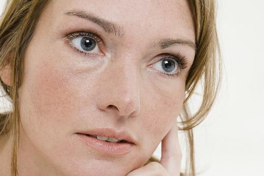 面部色斑知多少 导致色斑的习惯大揭秘