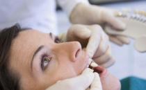 洗牙问题大揭秘 全方位告诉你洗牙好与坏