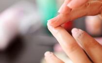 从指甲上看出病症 读懂指甲信息了解健康状况